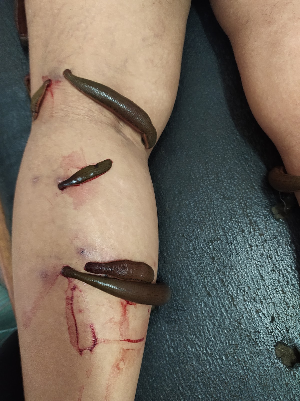 Shri Guru Angad Dev Ayurvedic Panchakarma treatment centre (A unit of Metro Health Clinic)